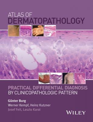 Atlas of Dermatopathology. Practical Differential Diagnosis by Clinicopathologic Pattern - Werner  Kempf 