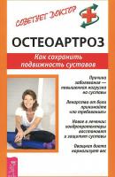 Остеоартроз. Как сохранить подвижность суставов - Кира Рогозинникова Советует доктор: тактика и стратегия здоровья