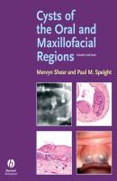 Cysts of the Oral and Maxillofacial Regions - Mervyn  Shear 