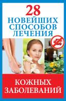 28 новейших способов лечения кожных заболеваний - Полина Голицына Новейшие способы лечения