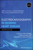 Electrocardiography in Ischemic Heart Disease - Antoni Bayés de Luna 