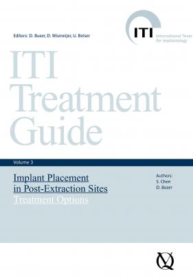 Implant Placement in Post-Extraction Sites - Отсутствует ITI Treatment Guide Series